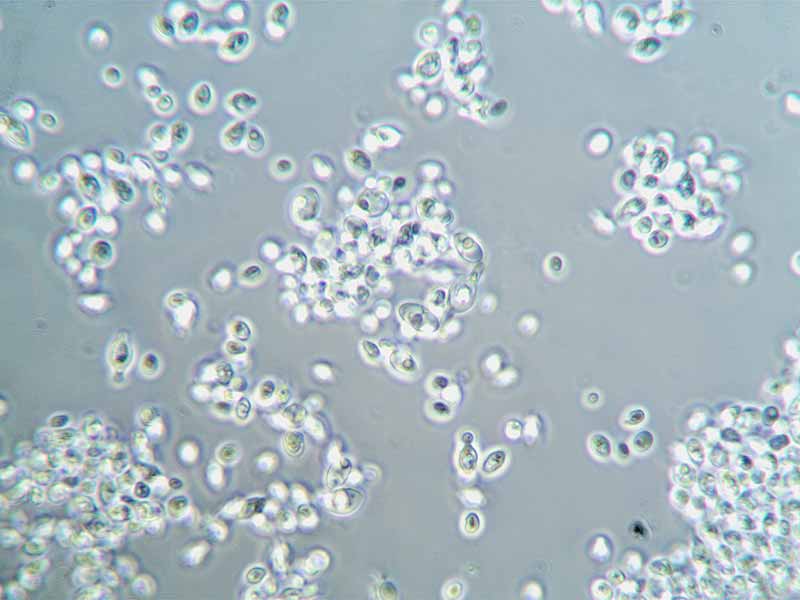 escarpment laboratories nay non-alcoholic yeast cells under microscope