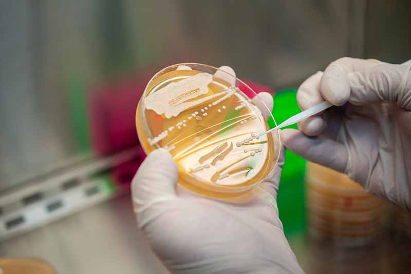 white labs non-alcoholic yeast